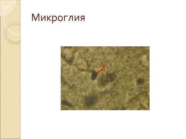Микроглия 