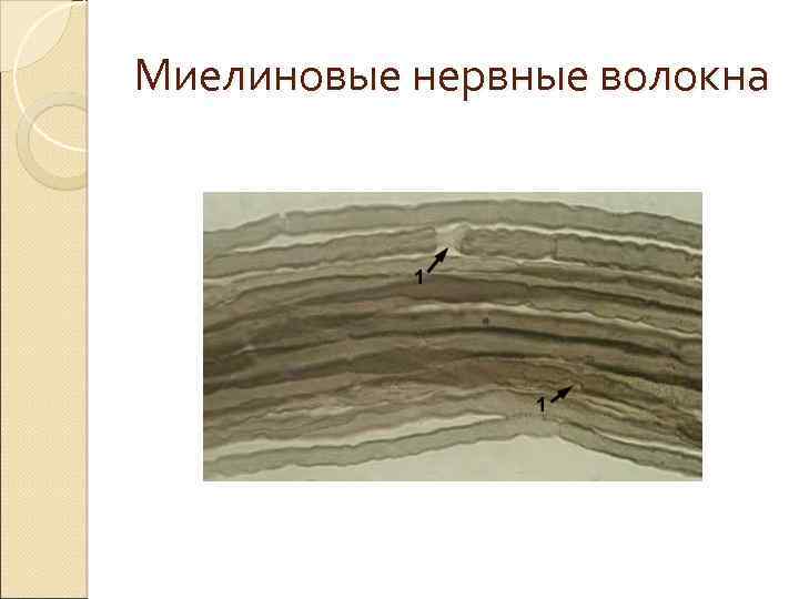 Миелиновые нервные волокна 