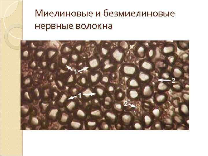 Миелиновые и безмиелиновые нервные волокна 