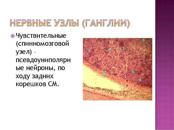 Чувствительные (спинномозговой узел) – псевдоуниполярн ые нейроны, по ходу задних корешков СМ. 