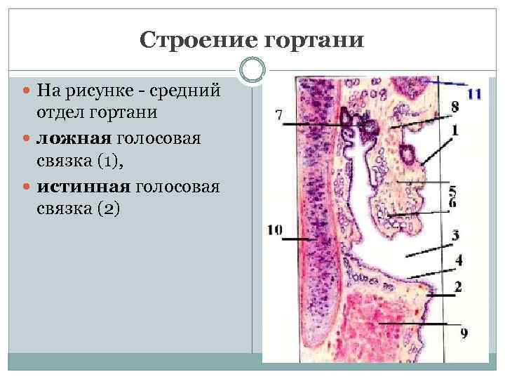 Строение гортани На рисунке - средний отдел гортани ложная голосовая связка (1), истинная голосовая