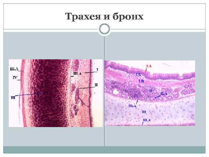 Трахея и бронх 