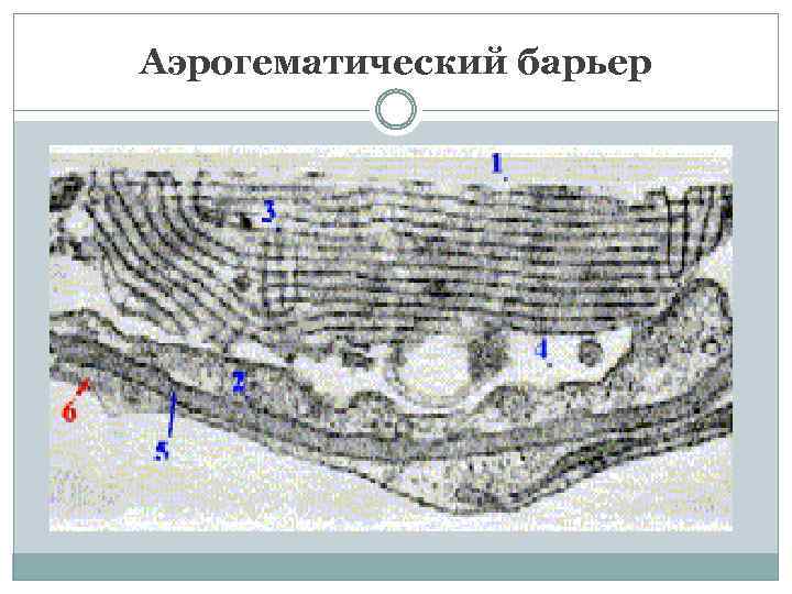 Аэрогематический барьер 