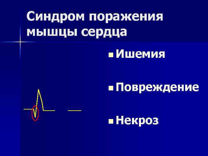 Синдром поражения мышцы сердца n Ишемия n Повреждение n Некроз 