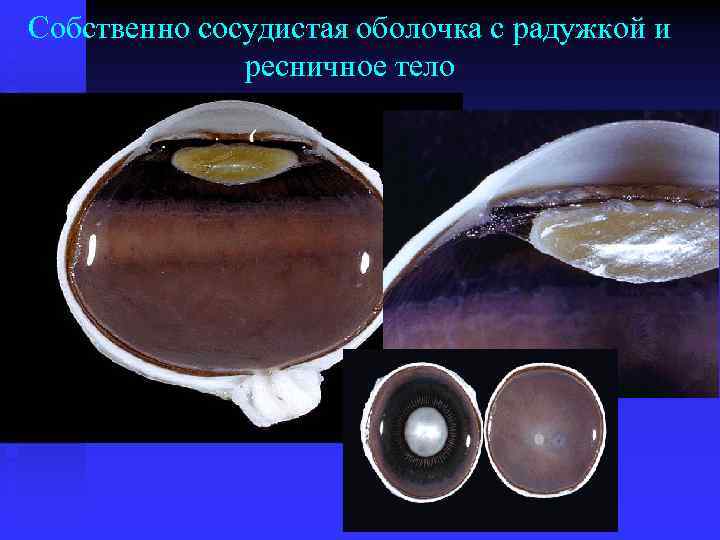 Собственно сосудистая оболочка с радужкой и ресничное тело 