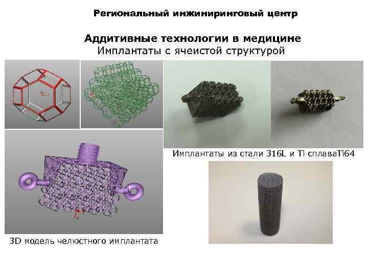 Региональный инжиниринговый центр Аддитивные технологии в медицине Имплантаты с ячеистой структурой Имплантаты из стали