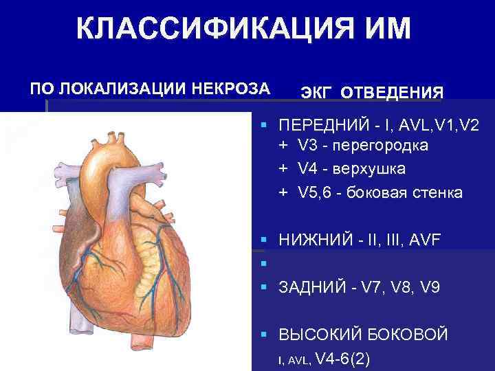  КЛАССИФИКАЦИЯ ИМ ПО ЛОКАЛИЗАЦИИ НЕКРОЗА ЭКГ ОТВЕДЕНИЯ § ПЕРЕДНИЙ - I, AVL, V