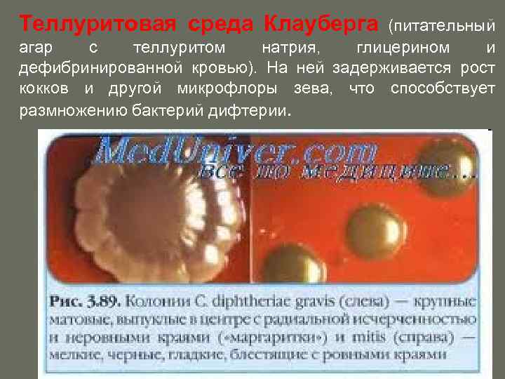 Теллуритовая среда Клауберга (питательный агар с теллуритом натрия, глицерином и дефибринированной кровью). На ней