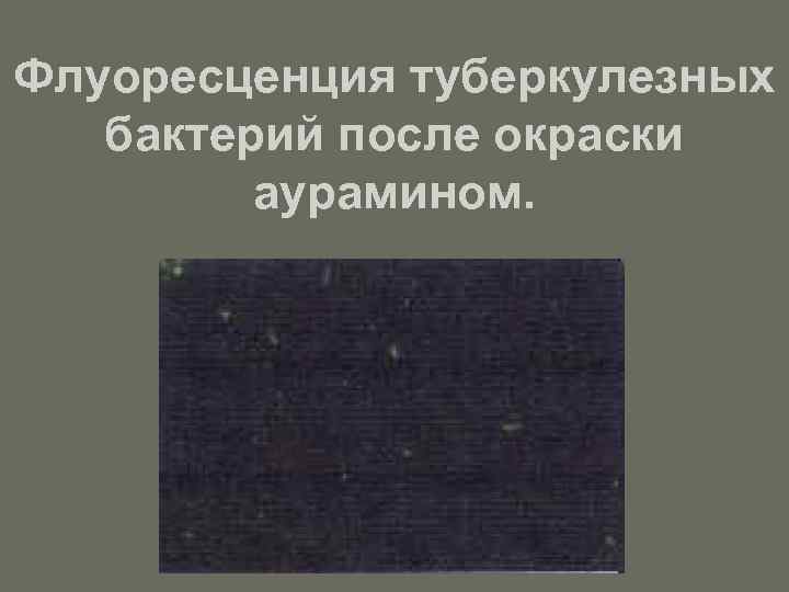 Флуоресценция туберкулезных бактерий после окраски аурамином. 