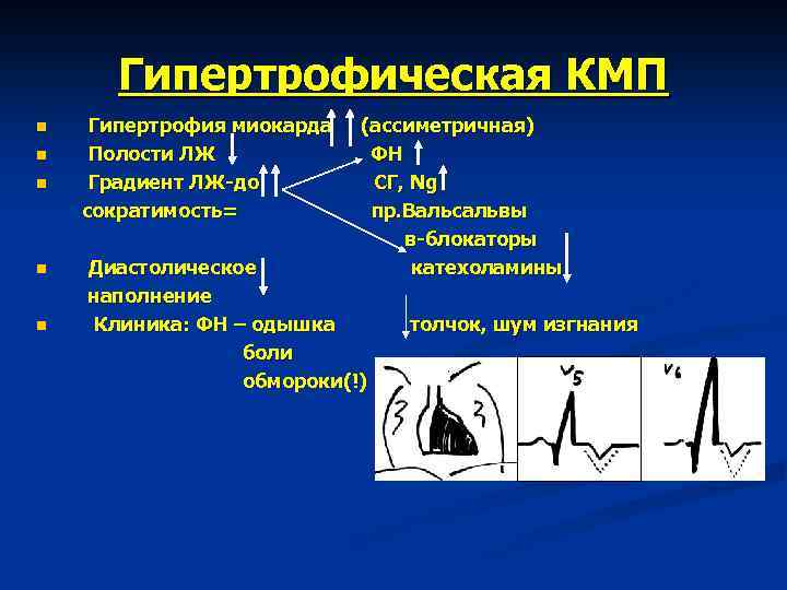 Гипертрофическая КМП n n n Гипертрофия миокарда Полости ЛЖ Градиент ЛЖ-до сократимость= (ассиметричная) ФН