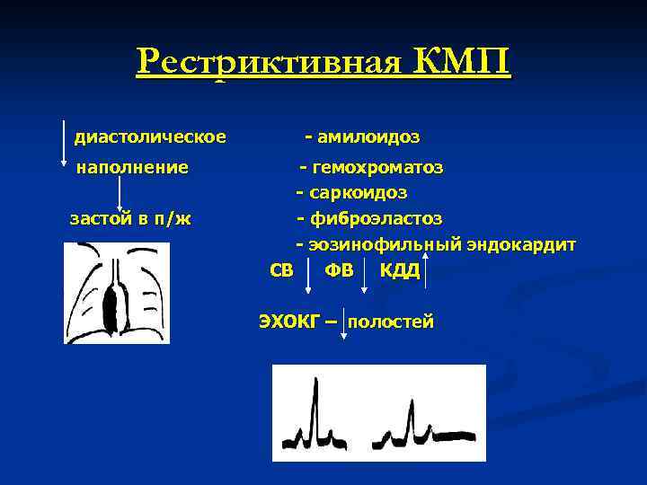 Рестриктивная КМП диастолическое наполнение застой в п/ж - амилоидоз - гемохроматоз - саркоидоз -
