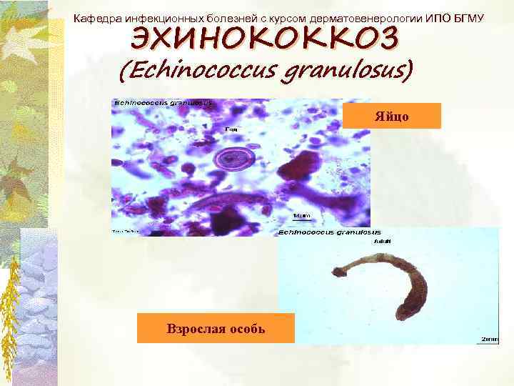 Кафедра инфекционных болезней с курсом дерматовенерологии ИПО БГМУ ЭХИНОКОККОЗ (Echinococcus granulosus) Яйцо Взрослая особь