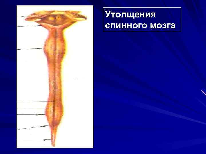 Утолщения спинного мозга. Утолщен ия спинногом мозга. Поясничное утолщение спинного мозга уровень. Утолщения спинного мозга функции.