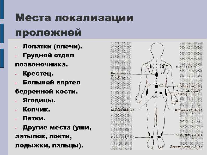 Статистика пролежней. Места локализации пролежней. Зоны риска образования пролежней.