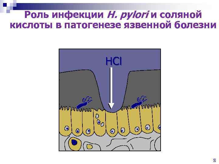 Роль инфекции H. pylori и соляной кислоты в патогенезе язвенной болезни HCl Просвет желудка