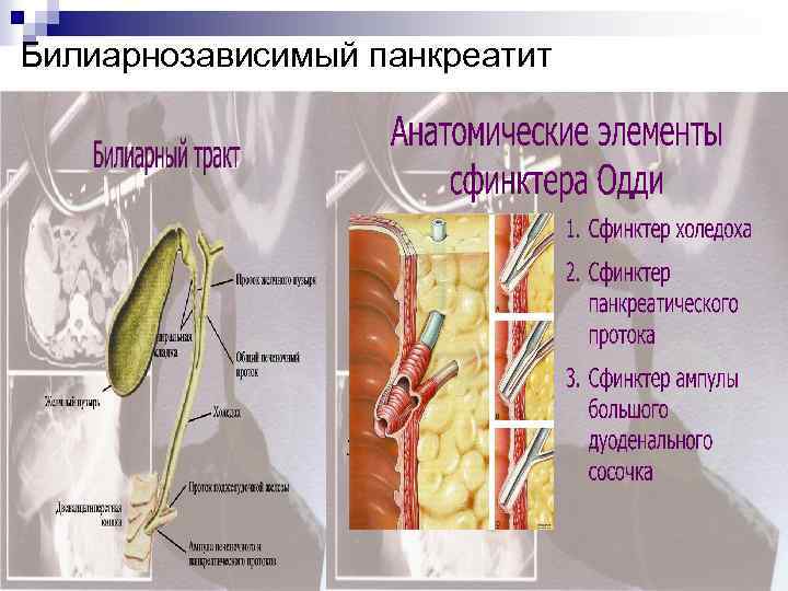 Билиарнозависимый панкреатит 