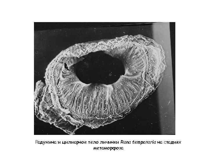 Радужина и цилиарное тело личинки Rana temporaria на стадиях метаморфоза 