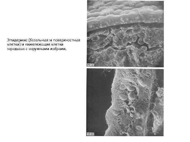 Эпидермис (базальные и поверхностные клетки) и нижележащие клетки зародыша с наружными жабрами. 