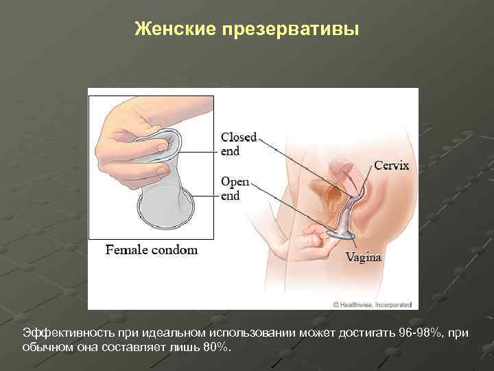 Женские презервативы Эффективность при идеальном использовании может достигать 96 -98%, при обычном она составляет