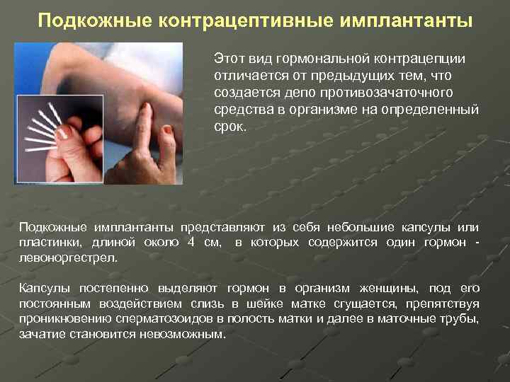 Подкожные контрацептивные имплантанты Этот вид гормональной контрацепции отличается от предыдущих тем, что создается депо