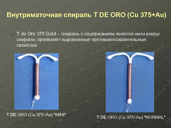 Внутриматочная спираль T DE ORO (Cu 375+Au) T de Oro 375 Gold – спираль