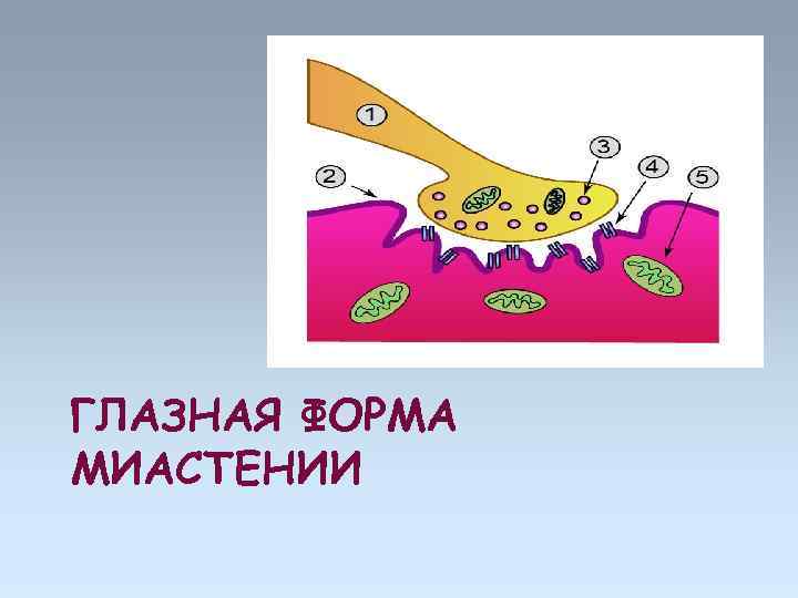 ГЛАЗНАЯ ФОРМА МИАСТЕНИИ 