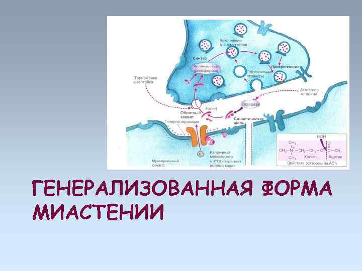 ГЕНЕРАЛИЗОВАННАЯ ФОРМА МИАСТЕНИИ 