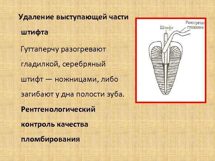 Методы обтурации корневых каналов презентация