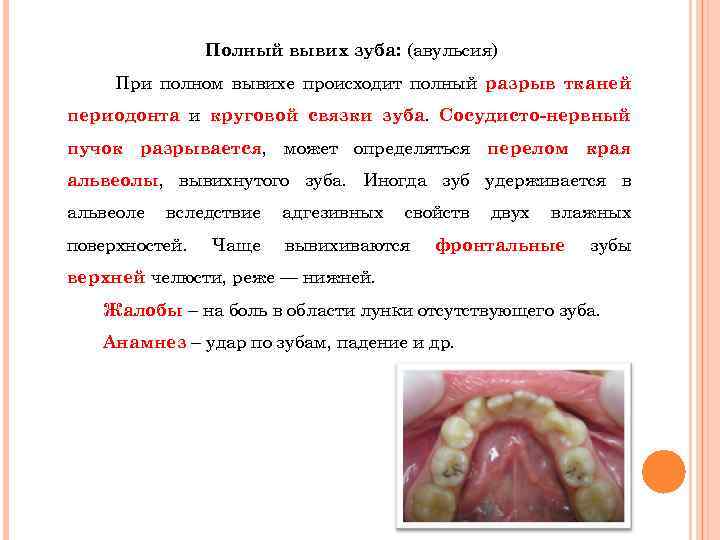 Полный вывих зуба: (авульсия) При полном вывихе происходит полный разрыв тканей периодонта и круговой