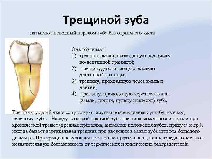 Трещиной зуба называют неполный перелом зуба без отрыва его части. Она различает: 1) трещину