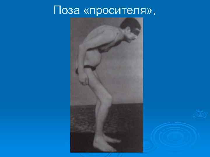 Поза «просителя» , 