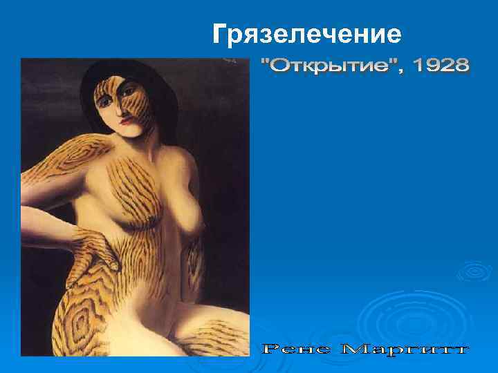 грязелечение 