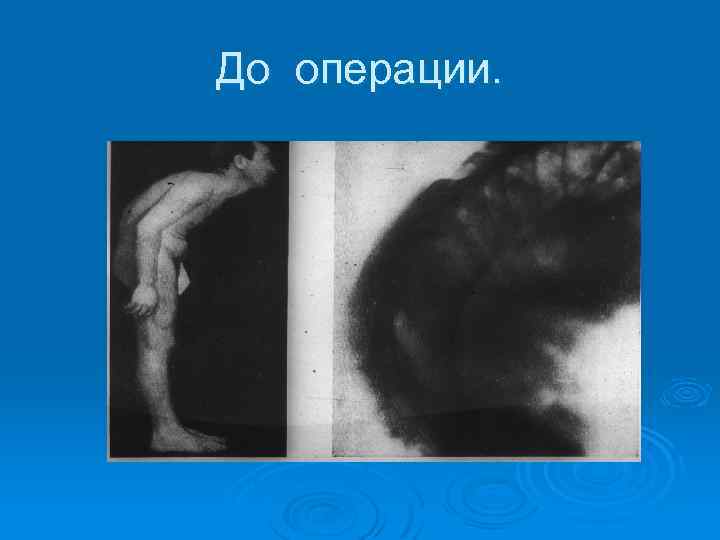До операции. 