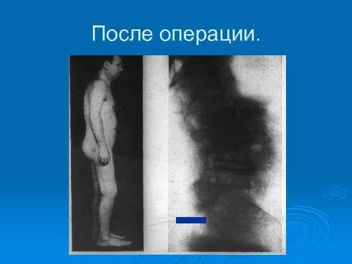 После операции. 