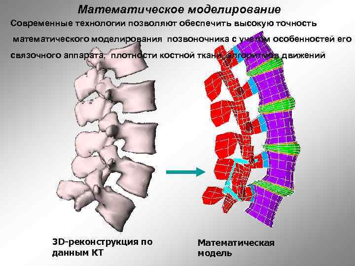 Математическое моделирование Современные технологии позволяют обеспечить высокую точность математического моделирования позвоночника с учетом особенностей