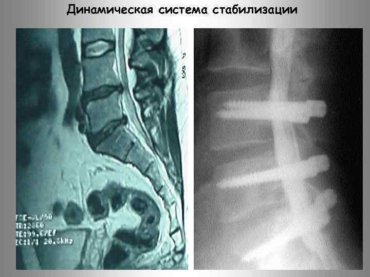 Динамическая система стабилизации 