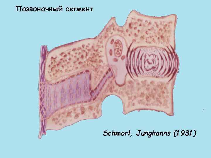 Позвоночный сегмент Schmorl, Junghanns (1931) 