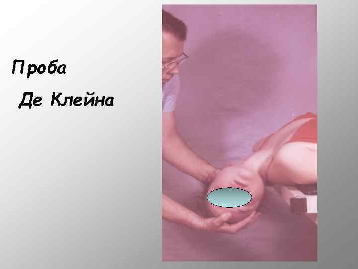 Проба Де Клейна 