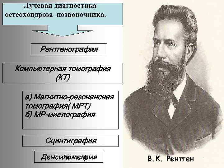 Лучевая диагностика остеохондроза позвоночника. Рентгенография Компьютерная томография (КТ) а) Магнитно-резонансная томография( МРТ) б) МР-миелография