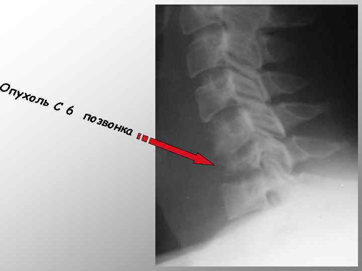 Опу хол ь C 6 п озво нка 