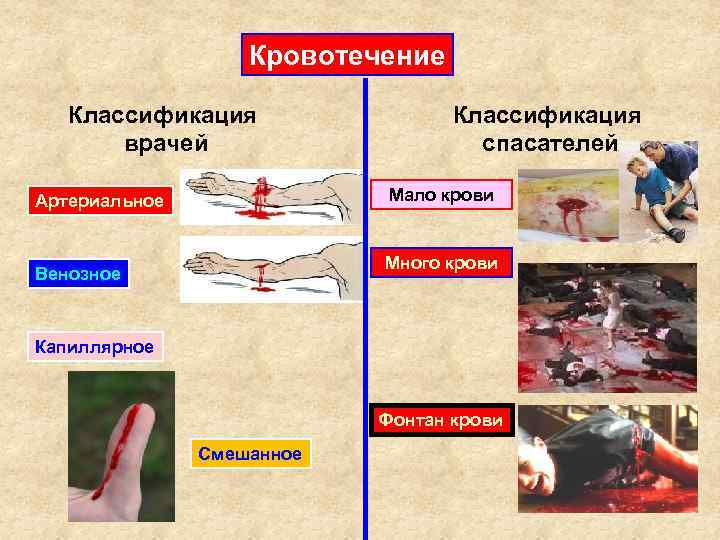 Кровотечение Классификация врачей Классификация спасателей Мало крови Артериальное Много крови Венозное Капиллярное Фонтан крови