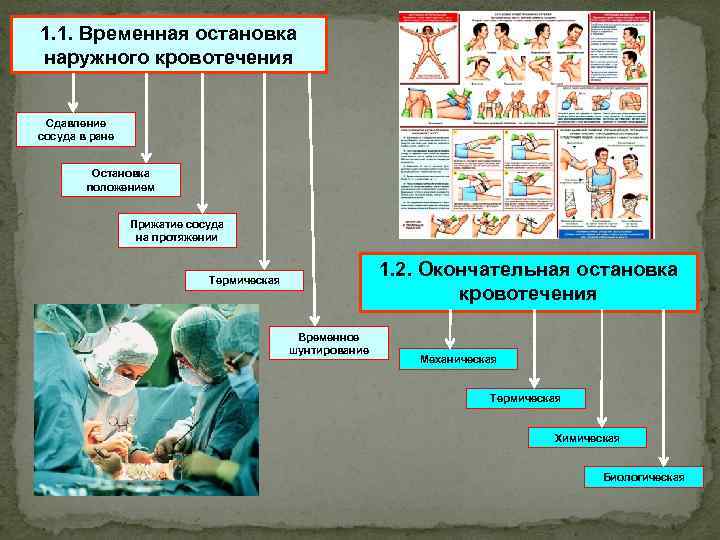 1. 1. Временная остановка наружного кровотечения Сдавление сосуда в ране Остановка положением Прижатие сосуда