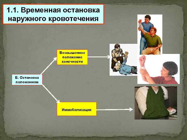 1. 1. Временная остановка наружного кровотечения Возвышенное положение конечности Б. Остановка положением Иммобилизация 