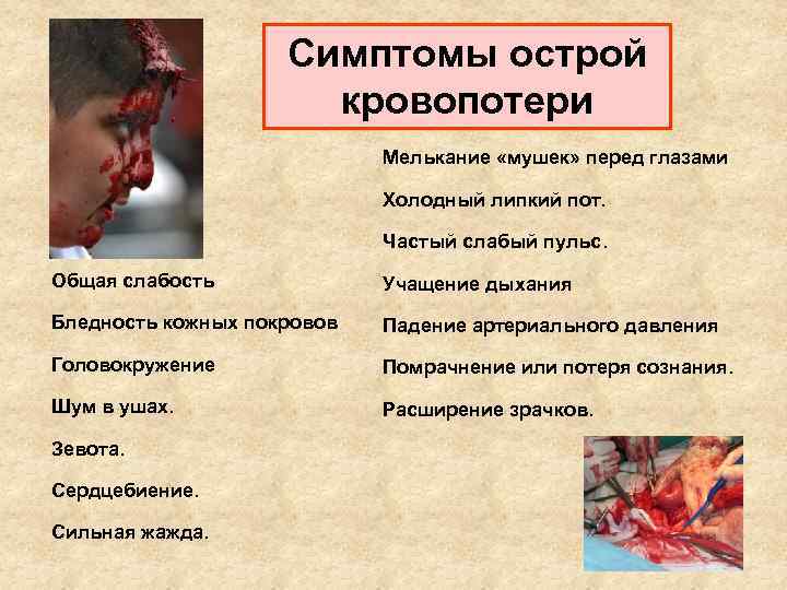 Симптомы острой кровопотери Мелькание «мушек» перед глазами Холодный липкий пот. Частый слабый пульс. Общая