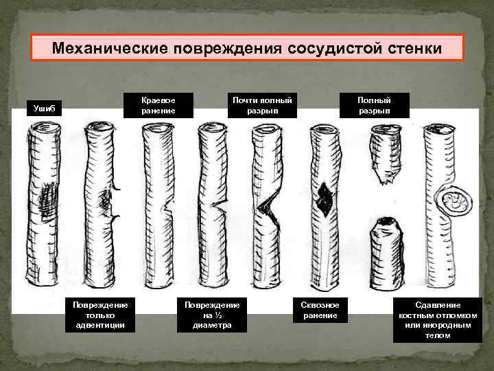 Механические повреждения автомобиля это