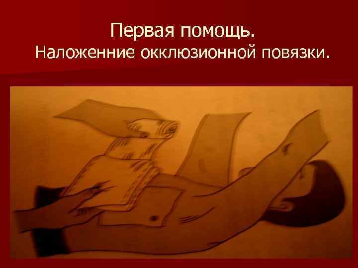 Первая помощь. Наложенние окклюзионной повязки. 