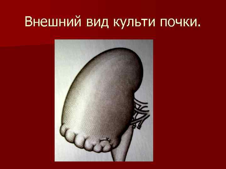 Внешний вид культи почки. 