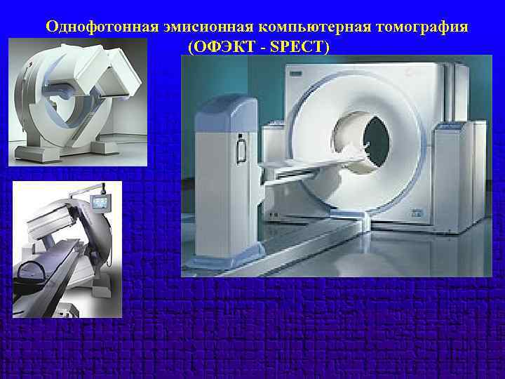 Однофотонная эмисионная компьютерная томография (ОФЭКТ - SPECT) 