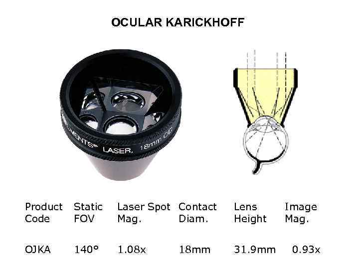 OCULAR KARICKHOFF Product Static Code FOV Laser Spot Contact Mag. Diam. Lens Height OJKA