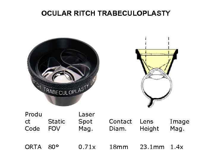 OCULAR RITCH TRABECULOPLASTY Produ ct Code ORTA Static FOV Laser Spot Mag. Contact Lens